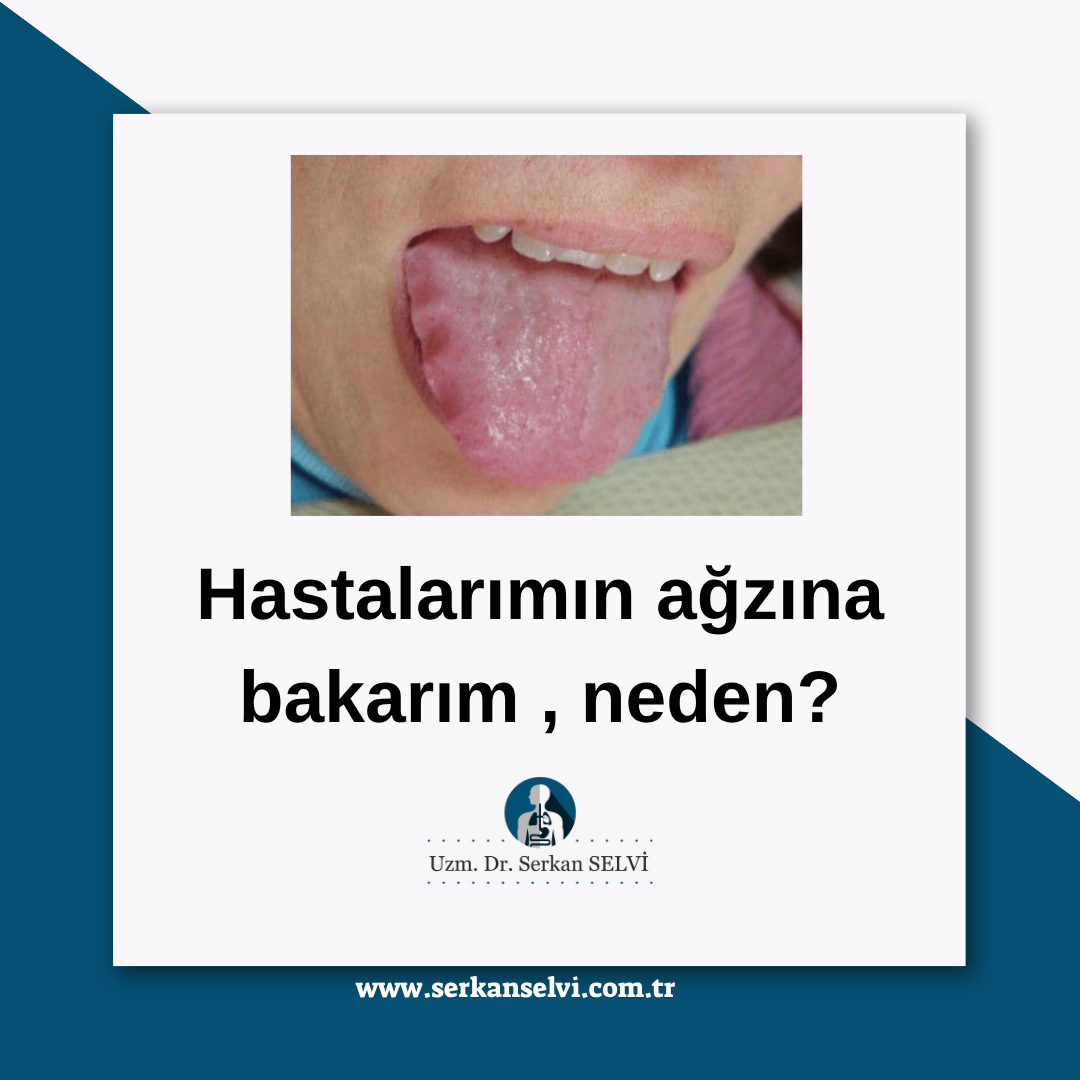 Hastalarımın ağzına bakarım , neden ?